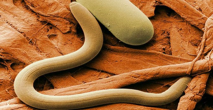 Длина тела червей-нематод составляет от 80 мкм до 8,4 м (такую ошеломляющую длину имеет паразит под названием Placentonema gigantissima, обитающий в плаценте кашалота)
