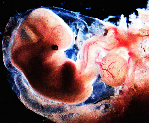 2b3949fa01e8f61361b1b4a9143220df Ученым могут разрешить выращивать эмбрионы специально для опытов
