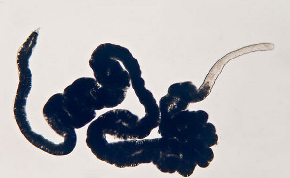 37 Что общего между червями без пищеварительной системы и митохондриями?