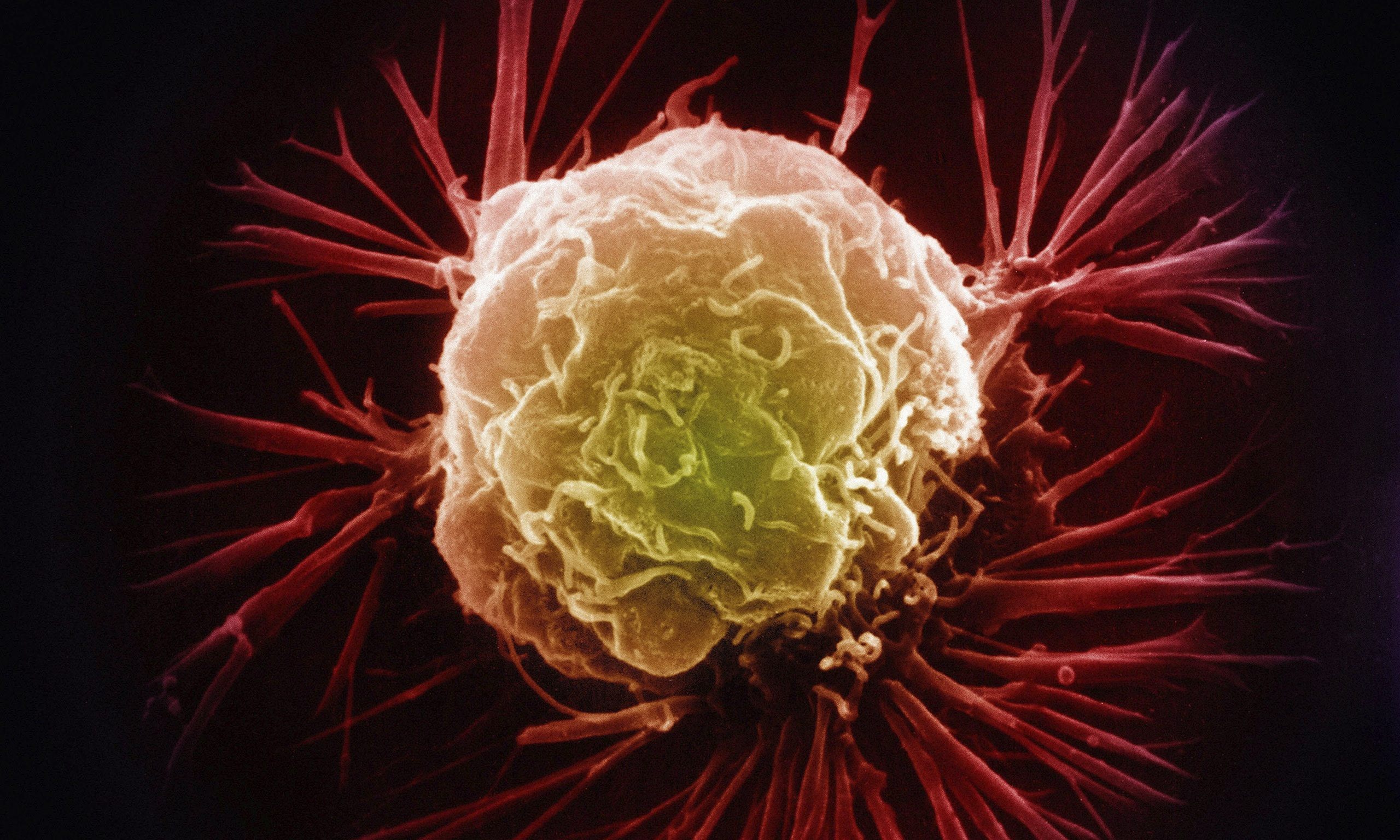 breast-cancer-cell-014 Шведские ученые пополнили копилку методов для борьбы с раковыми опухолями