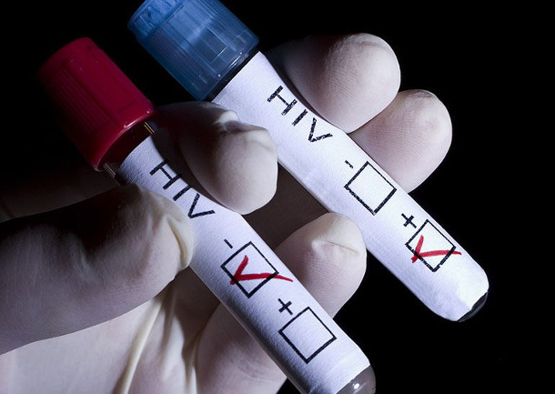 dt_140626_hiv_blood_vial_800x600-770x547 Впервые в истории человека удалось полностью вылечить от ВИЧ